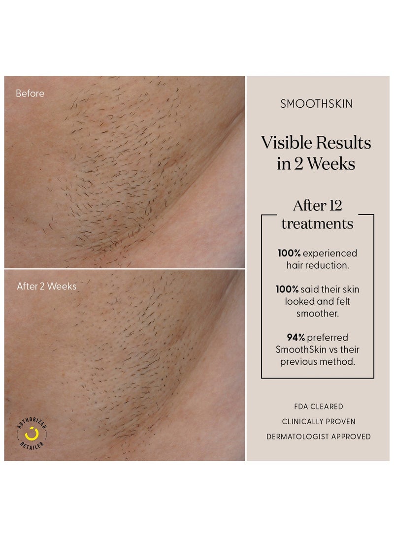 SMOOTHSKIN Pure Adapt IPL (White) IPL Laser Hair Removal Device for Men & Women, Long-Lasting, Hair-Free Skin at Home - Image 4